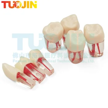 5 бр. Стоматологични эндодонтическая модел за практикуване на зъбите, Обучаващи файлове за коренови канали, Учебни блокове, смола, демонстрация на RCT, стоматология за преподаването на студенти