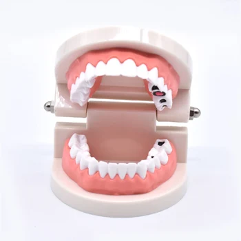 Маркетингови модели на кариес Обучение Модели на зъбите Обучение грижа за зъбите на Стоматологични инструменти Стоматологичен материал на Зъбите и Лабораторно оборудване